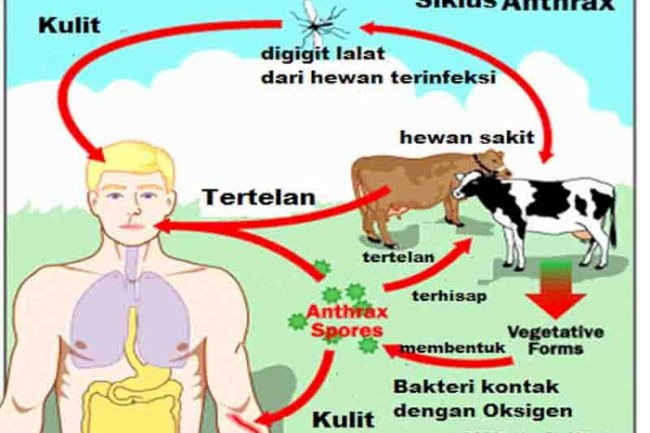 fakta tentang Antraks